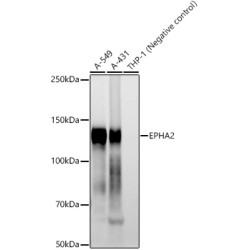 EPHA2 Rabbit mAb