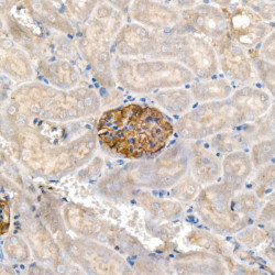 Nephrin Rabbit mAb