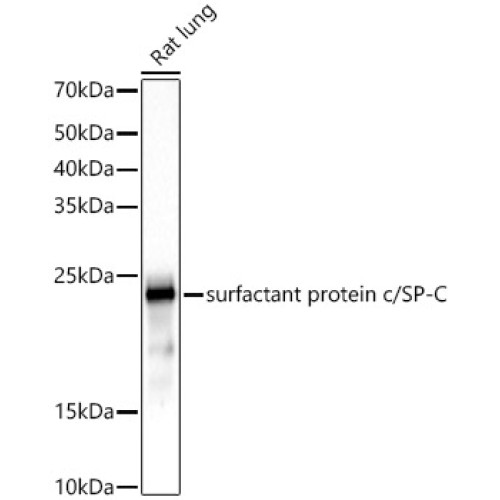 SFTPC Rabbit mAb