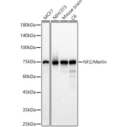 [KD Validated] NF2/Merlin Rabbit mAb