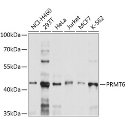 PRMT6 Rabbit pAb
