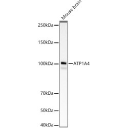ATP1A4 Rabbit mAb