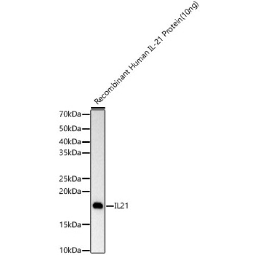 IL21 Rabbit mAb