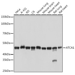 α-Actin-1 (ACTA1) Rabbit mAb