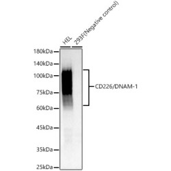 CD226/DNAM-1 Rabbit mAb