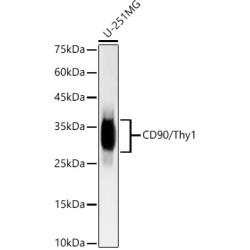 [KD Validated] CD90/Thy1 Rabbit mAb