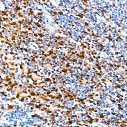 MUM1 Rabbit mAb