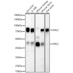 [KD Validated] GALC Rabbit mAb