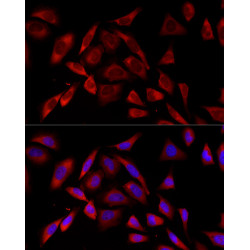 PKC alpha Rabbit mAb