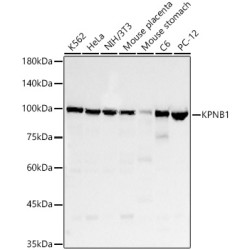 KPNB1 Rabbit mAb