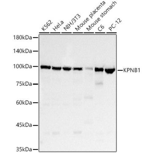 KPNB1 Rabbit mAb