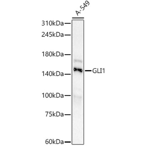 GLI1 Rabbit mAb