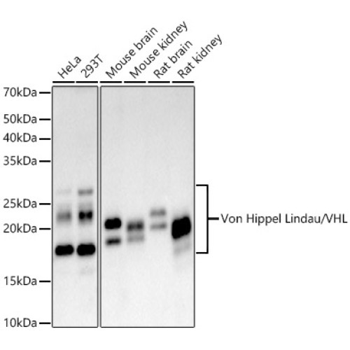 [KO Validated] Von Hippel Lindau/VHL Rabbit mAb