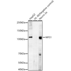 WFS1 Rabbit mAb