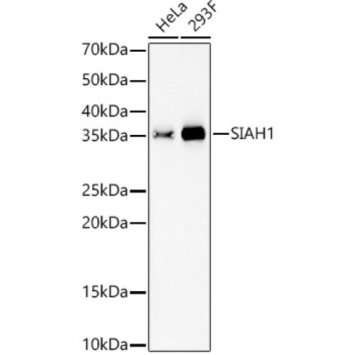 SIAH1 Rabbit mAb