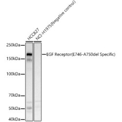 EGF Receptor (E746-A750del Specific) Rabbit  pAb