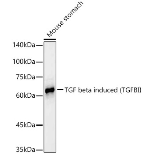 TGF beta induced (TGFBI)  Rabbit mAb