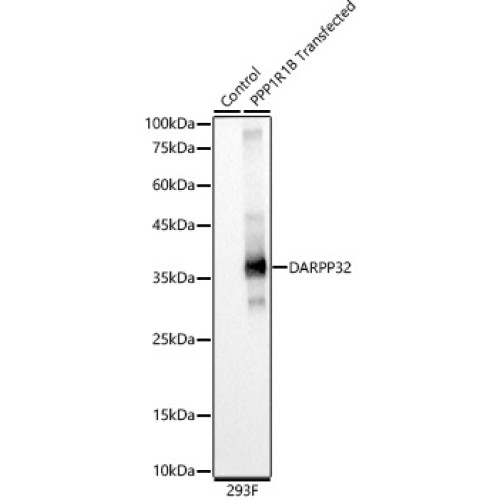 DARPP32 Rabbit mAb