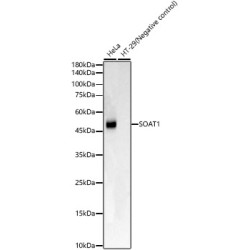 SOAT1 Rabbit mAb