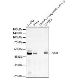 VDR Rabbit mAb