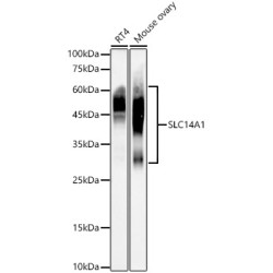 SLC14A1 Rabbit mAb