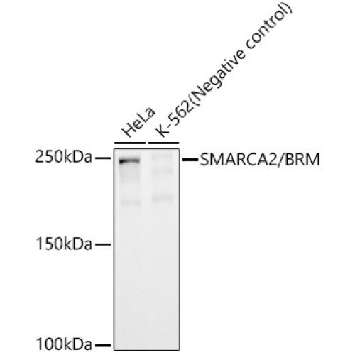 SMARCA2 / BRM Rabbit mAb