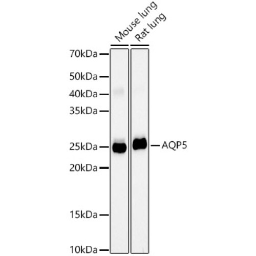 AQP5 Rabbit mAb
