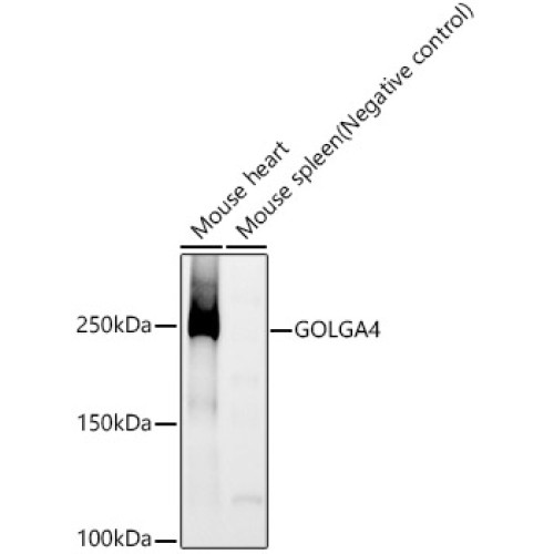 GOLGA4 Rabbit mAb