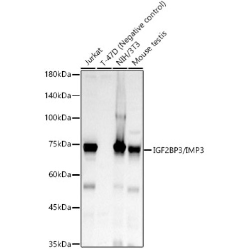 IGF2BP3/IMP3 Rabbit mAb