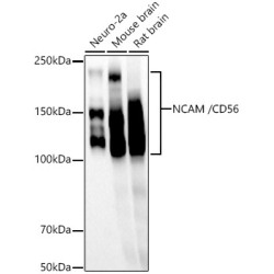 NCAM /CD56 Rabbit mAb
