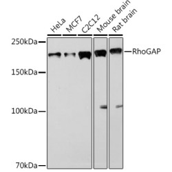 RhoGAP Rabbit mAb
