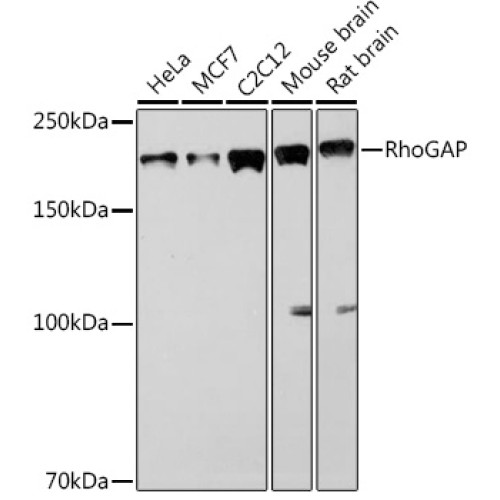 RhoGAP Rabbit mAb