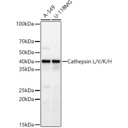 Cathepsin L Rabbit mAb