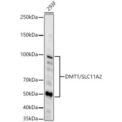 DMT1/SLC11A2 Rabbit mAb