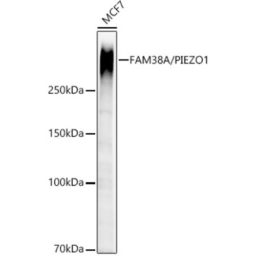 [KO Validated] FAM38A/PIEZO1 Rabbit mAb