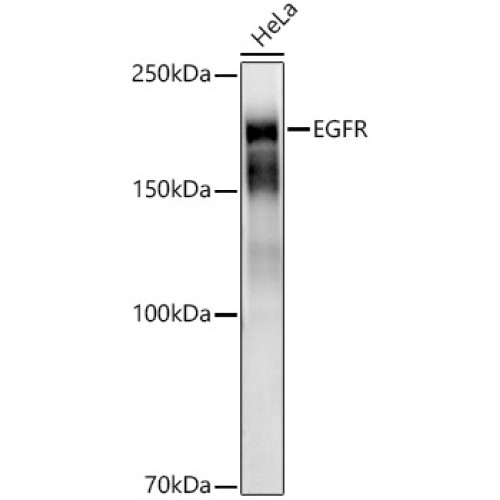 [KD Validated] EGFR Rabbit mAb