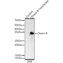 Orexin B Rabbit mAb