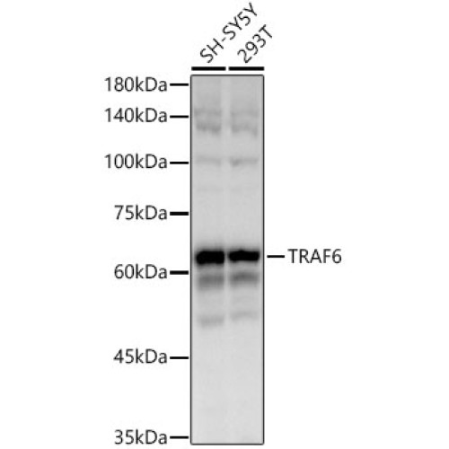 TRAF6 Rabbit mAb