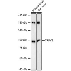 TRPV1 Rabbit mAb