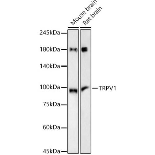 TRPV1 Rabbit mAb