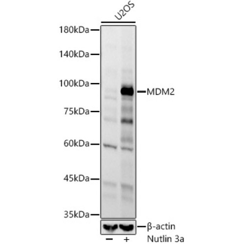 MDM2 Rabbit mAb
