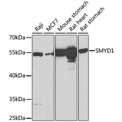SMYD1 Rabbit pAb