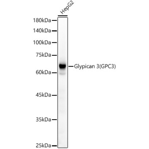 Glypican 3 (GPC3) Rabbit mAb