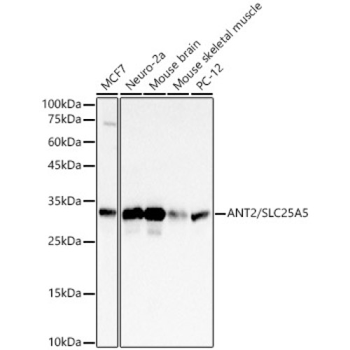 ANT2/SLC25A5 Rabbit mAb