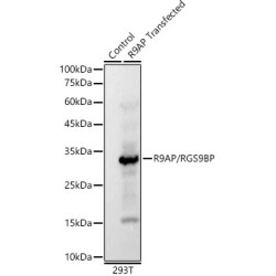 R9AP/RGS9BP Rabbit mAb