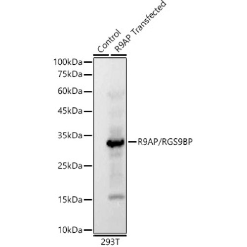 R9AP/RGS9BP Rabbit mAb