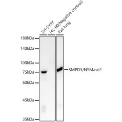 SMPD3/NSMase2 Rabbit mAb