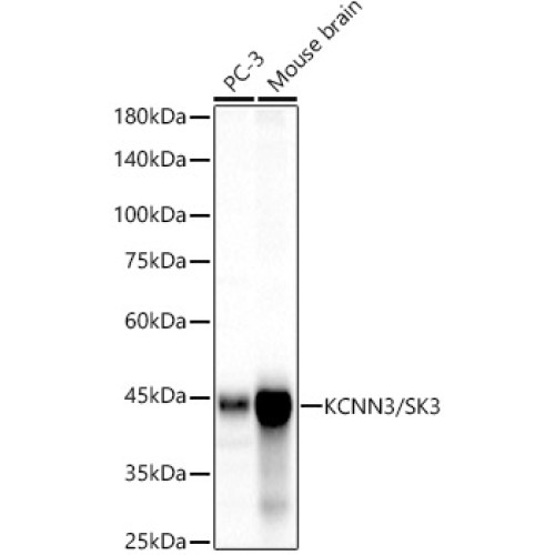 KCNN3/SK3 Rabbit mAb