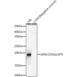GPIX/CD42a/GP9 Rabbit mAb