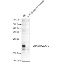 GPIX/CD42a/GP9 Rabbit mAb